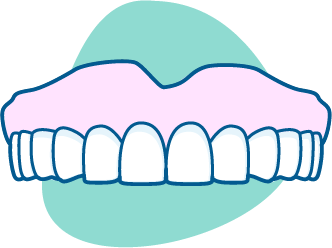 overdenture graphic