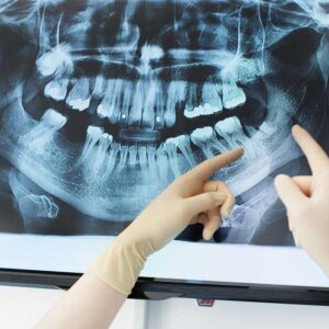 dental x-ray